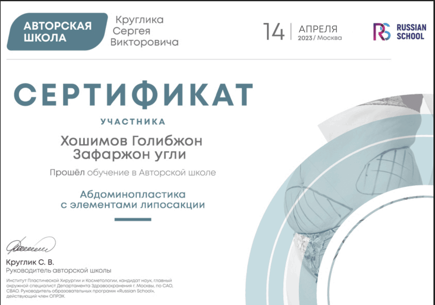Абдоминопластика с элементами липосакции